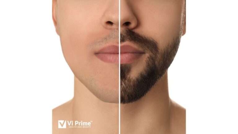 Vi Prime invokes the Pogonophile in you to escalate the Beard Boom in India