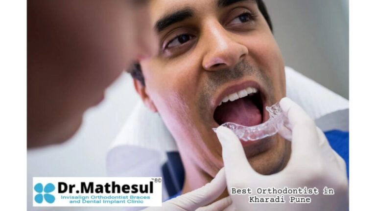 Trusted Orthodontist in Kharadi Pune